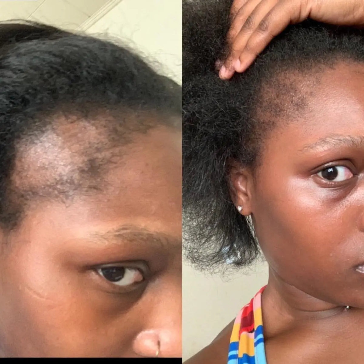 Jar of Mega Edge and Hair Growth Grease designed to promote edge regrowth, nourish the scalp, and strengthen kinky, coily, and curly hair with a natural formula.