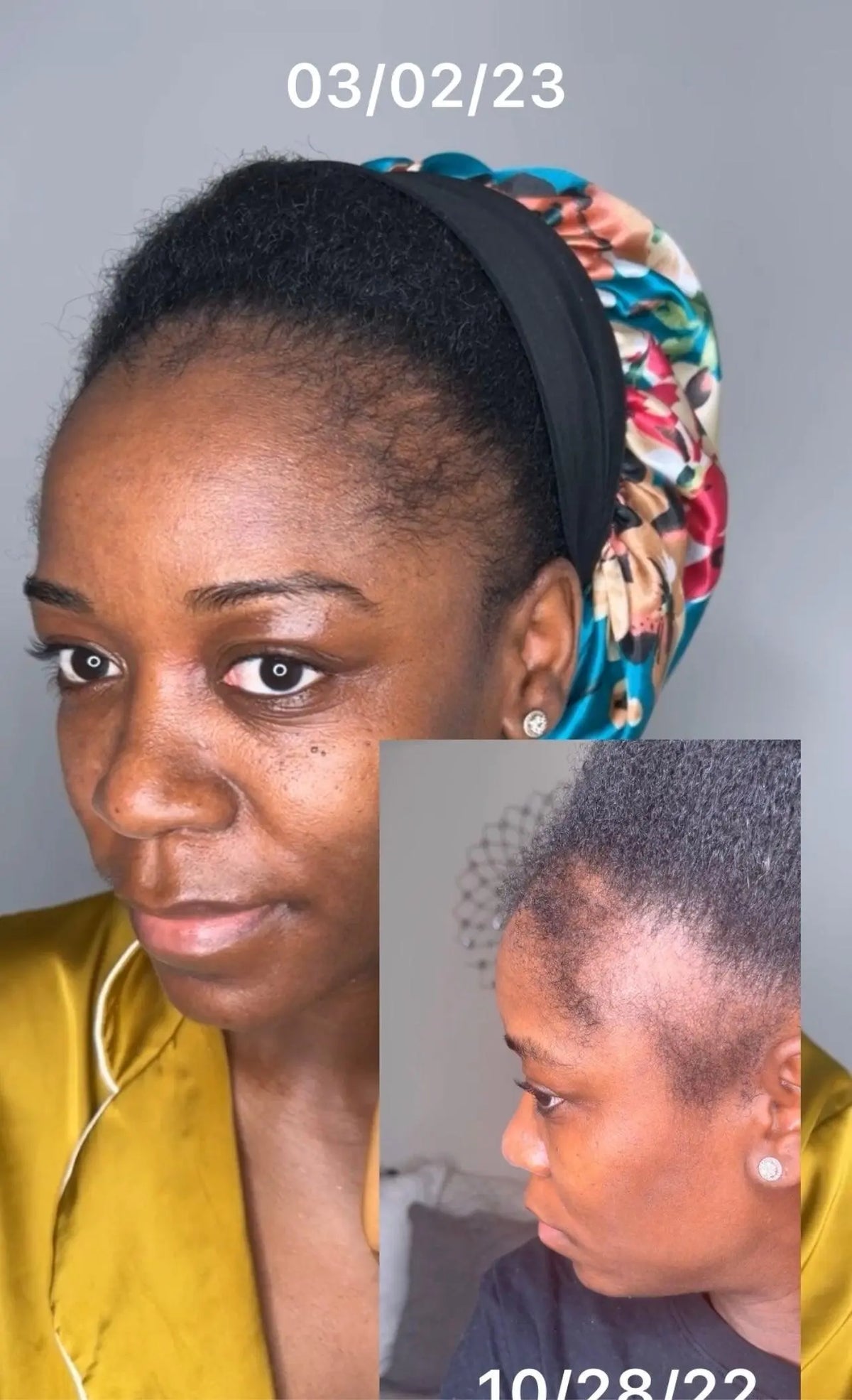 Jar of Mega Edge and Hair Growth Grease designed to promote edge regrowth, nourish the scalp, and strengthen kinky, coily, and curly hair with a natural formula.