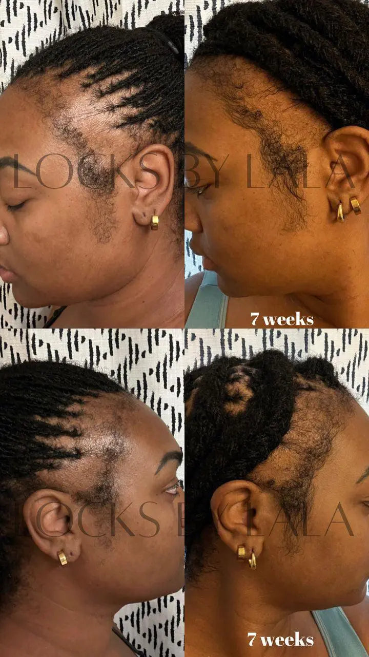 Jar of Mega Edge and Hair Growth Grease designed to promote edge regrowth, nourish the scalp, and strengthen kinky, coily, and curly hair with a natural formula.