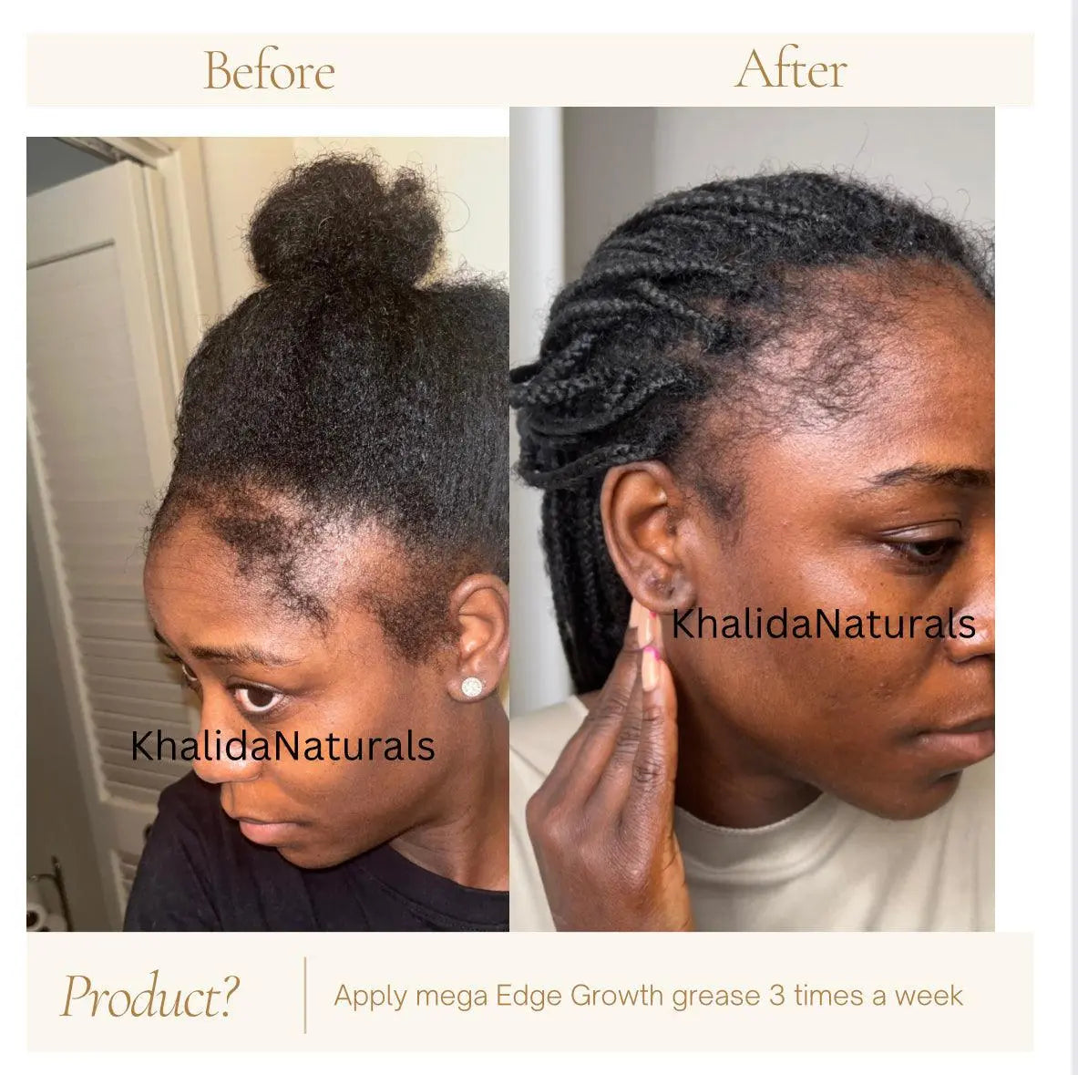 Jar of Mega Edge and Hair Growth Grease designed to promote edge regrowth, nourish the scalp, and strengthen kinky, coily, and curly hair with a natural formula.