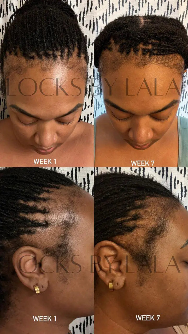 Mega Edge & Hair Growth Grease KhalidaNaturals